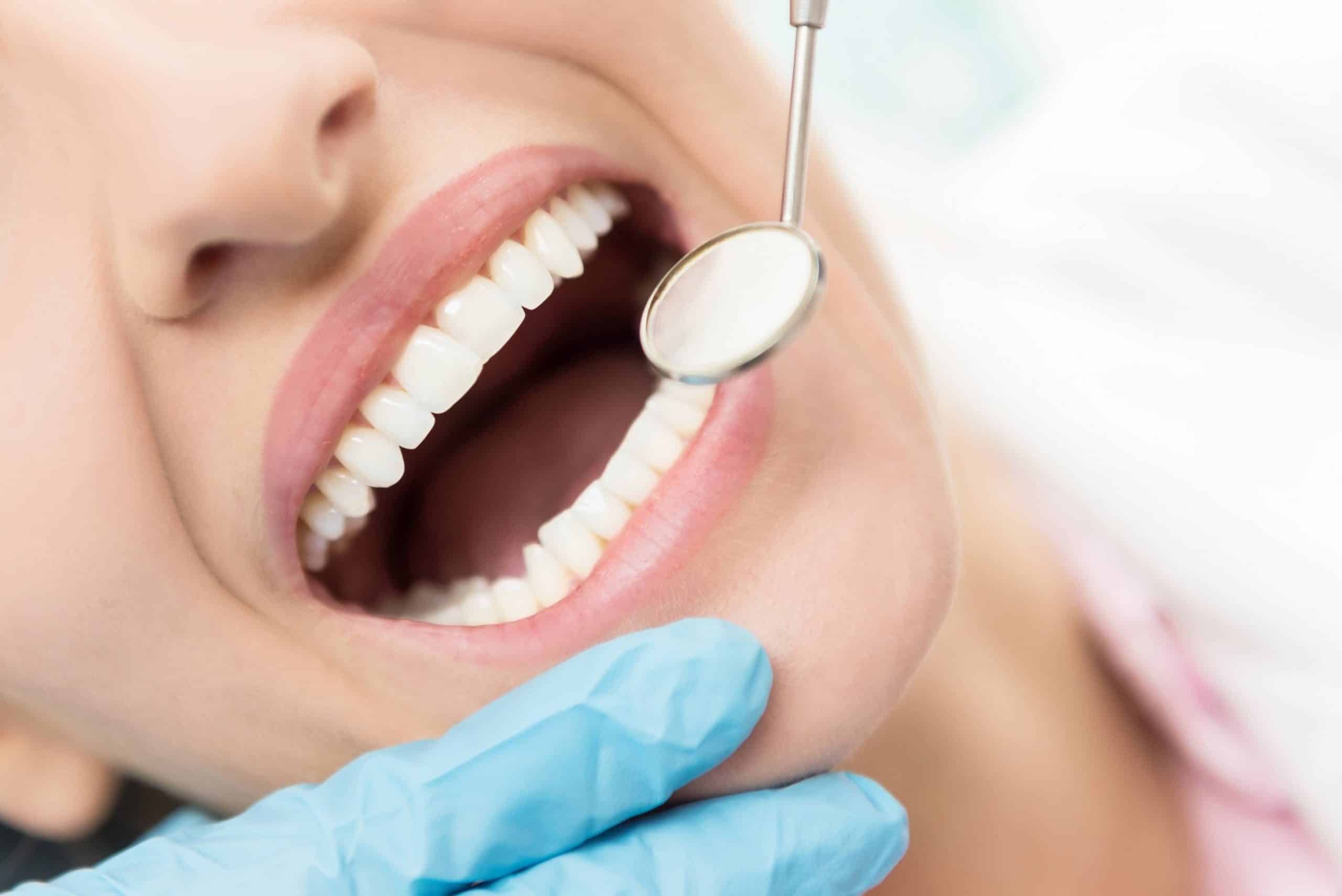 Prótese dentária de silicone: conheça essa e outras opções de