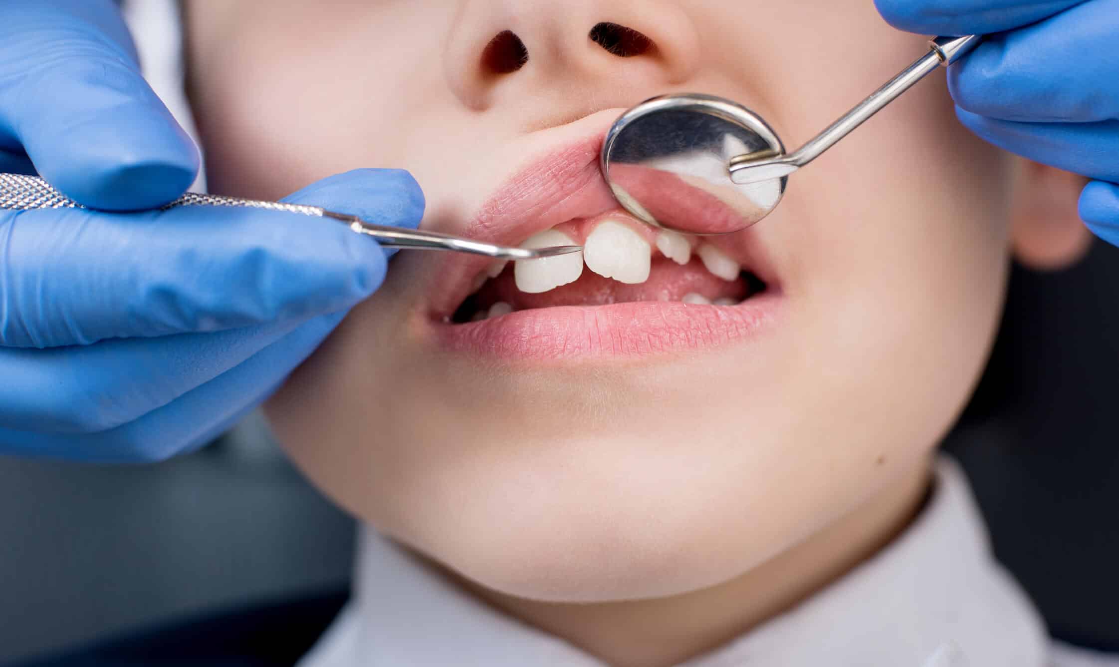 Ronco e dor? 10 sinais de que você precisa de um dentista