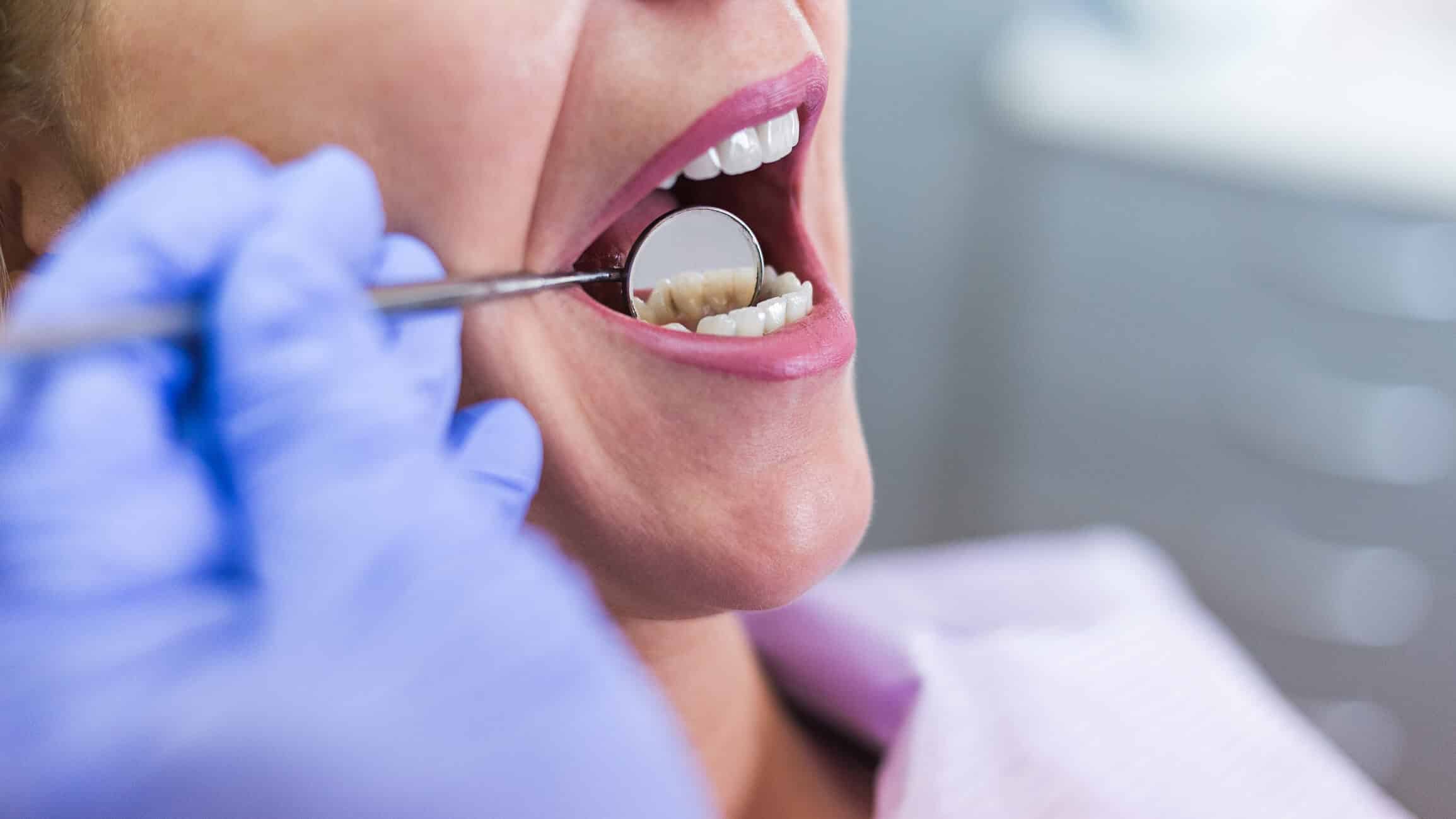 Boca Aberta Com Língua Para Fora E Dentes Incisivos Superiores