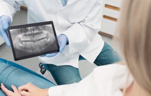 radiografia dos dentes